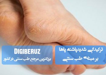 «ترکیدگی شدید پاشنه پا و خشکی لب پایین در طب سنتی؛ علل، تشخیص مزاجی و راهکارهای درمان طبیعی»