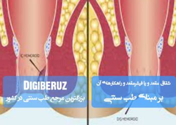 «شقاق (فیشر) مقعد و راهکارهای درمان آن در طب سنتی؛ روشهای طبیعی برای تسکین و بهبود»