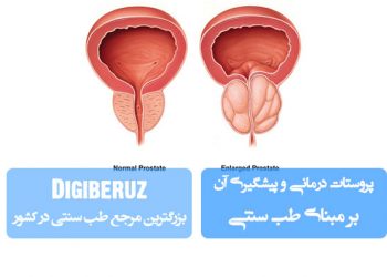 «درمان و پیشگیری بیماریهای پروستات در طب سنتی؛ رویکردهای گیاهی و تعادل مزاج»