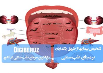 تشخیص بیماریها از طریق رنگ زبان؛ بررسی نشانههای بالینی و تأثیر مزاجها در طب سنتی