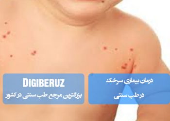 درمان سرخک در طب سنتی؛ تنظیم مزاج گرم، پاکسازی صفرابر و تقویت دفاع بدن با گیاهان دارویی مؤثر