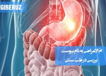 یبوست: بررسی علت و راههای درمان آن به عنوان "امالامراض" در طب سنتی، برای سلامتی گوارش.