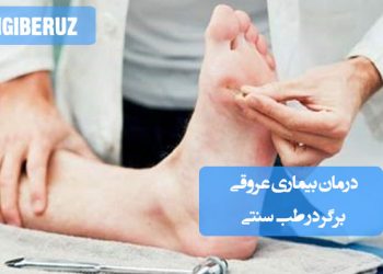 درمان بیماری عروقی برگر با داروهای گیاهی و اصلاح سبک زندگی در طب سنتی برای بهبود گردش خون