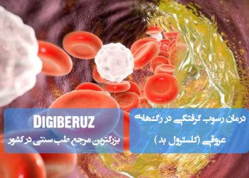 درمان رسوب کلسترول بد در رگ‌ها با طب سنتی | راهکارهای گیاهی برای پاکسازی عروق و بهبود گردش خون