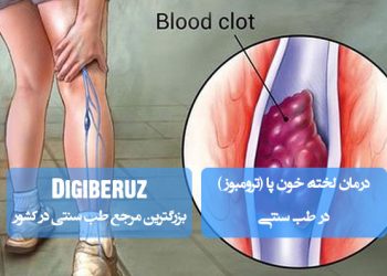 درمان لخته خون پا با رویکرد طب سنتی | نسخه‌های گیاهی برای ترومبوز و بهبود جریان خون در اندام‌ها