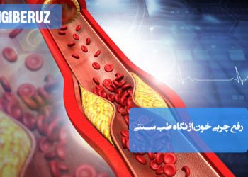 روشهای طب سنتی برای کاهش چربی خون با گیاهان دارویی و اصلاح سبک زندگی طبیعی