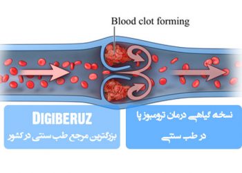 درمان ترومبوز وریدی پا با نسخه‌های گیاهی طب سنتی | راهکارهای طبیعی برای بهبود گردش خون
