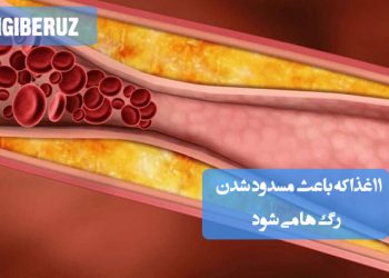 شناخت ۱۱ خوراکی مضر که در طب سنتی عامل انسداد عروق و تضعیف گردش خون شناخته میشوند