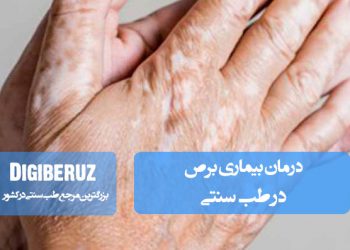 درمان بیماری برص در طب سنتی با استفاده از گیاهان دارویی، تقویت سیستم ایمنی و روشهای طبیعی