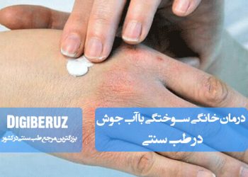 درمان خانگی سوختگی با آب جوش در طب سنتی با روشهای طبیعی شامل استفاده از گیاهان دارویی و مراقبتهای پوستی