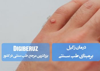 درمان زگیل با رویکردهای مؤثر طب سنتی و استفاده از ترکیبات گیاهی با خواص ضدویروسی