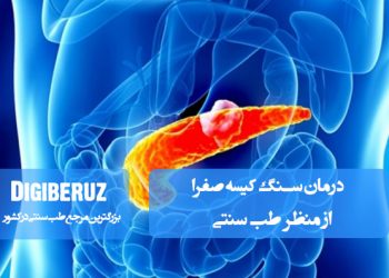 درمان سنگ کیسه صفرا در طب سنتی با استفاده از گیاهان صفراآور، تنظیم مزاج و روشهای طبیعی پاکسازی