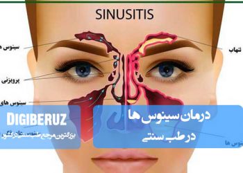 درمان التهاب و احتقان سینوسها در طب سنتی با گیاهان ضدالتهاب، بخور گیاهی و اصلاح مزاج برای تسکین علائم