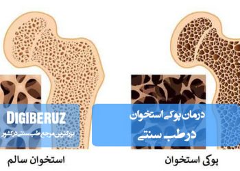 درمان پوکی استخوان در طب سنتی با استفاده از گیاهان دارویی، تغذیه مناسب و تقویت استخوان‌ها