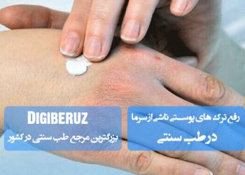 رفع ترک‌های پوستی ناشی از سرما با درمان‌های طب سنتی شامل مرطوب‌سازی و استفاده از روغن‌های طبیعی