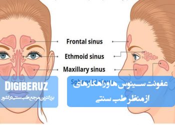 عفونت سینوسها و راهکارهای طب سنتی برای درمان شامل گیاهان ضدباکتری، بخورهای گیاهی و تنظیم مزاج