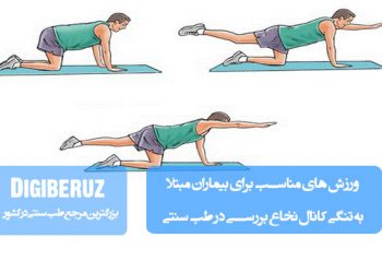 ورزشهای تخصصی طب سنتی برای بهبود بیماران مبتلا به تنگی کانال نخاع و کاهش درد و التهاب