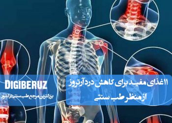 ۱۱ غذای مفید برای کاهش درد آرتروز در طب سنتی با تمرکز بر خواص ضدالتهابی و تقویت مفاصل
