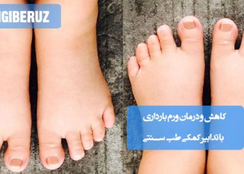 کاهش و درمان ورم بارداری در طب سنتی؛ مصرف خوراکی‌های ضدالتهابی، ماساژ با روغن‌های گیاهی، تنظیم تغذیه و روش‌های طبیعی بهبود