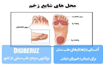 درمان زخم پای دیابتی با طب سنتی؛ استفاده از آلوئهورا، روغن نارگیل، عسل، کنترل قند خون، بهبود گردش خون و مراقبت از زخم برای تسریع بهبودی