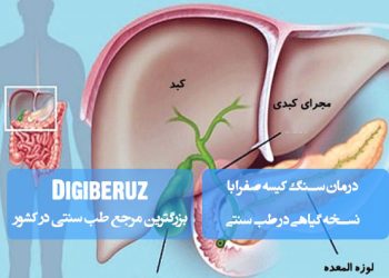 درمان سنگ کیسه صفرا با نسخه گیاهی در طب سنتی؛ مصرف آب سیب، سرکه سیب، گیاه قاصدک، خار مریم، کنگر فرنگی، روغن کرچک، نعناع و آب لیمو