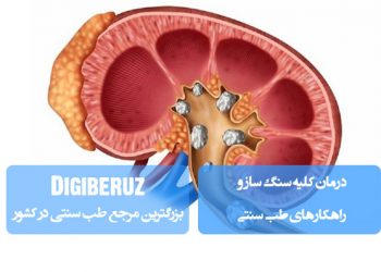درمان کلیه سنگ ساز و راهکارهای طب سنتی