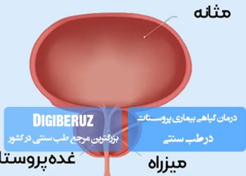 درمان گیاهی بیماری پروستات در طب سنتی
