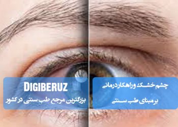 چشم خشک و راهکار درمانی بر مبنای طب سنتی