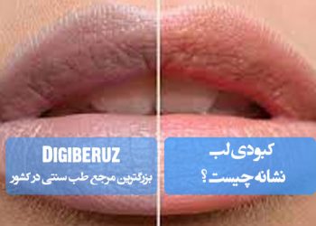 دهان شویه های طبیعی در طب سنتی