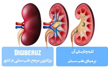 کلیه و نارسایی آن مبنای طب سنتی