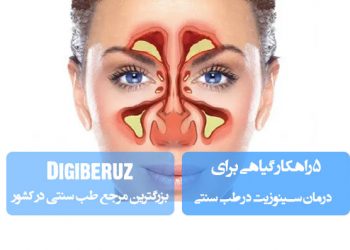 ۵ راهکار گیاهی برای درمان سینوزیت؛ بخور بابونه، مصرف زنجبیل، روغنمالی با سیاهدانه، دمنوش آویشن، پرهیز از غذاهای سرد و تقویت سیستم ایمنی