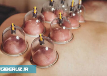چه موقع به حجامت نیاز داریم